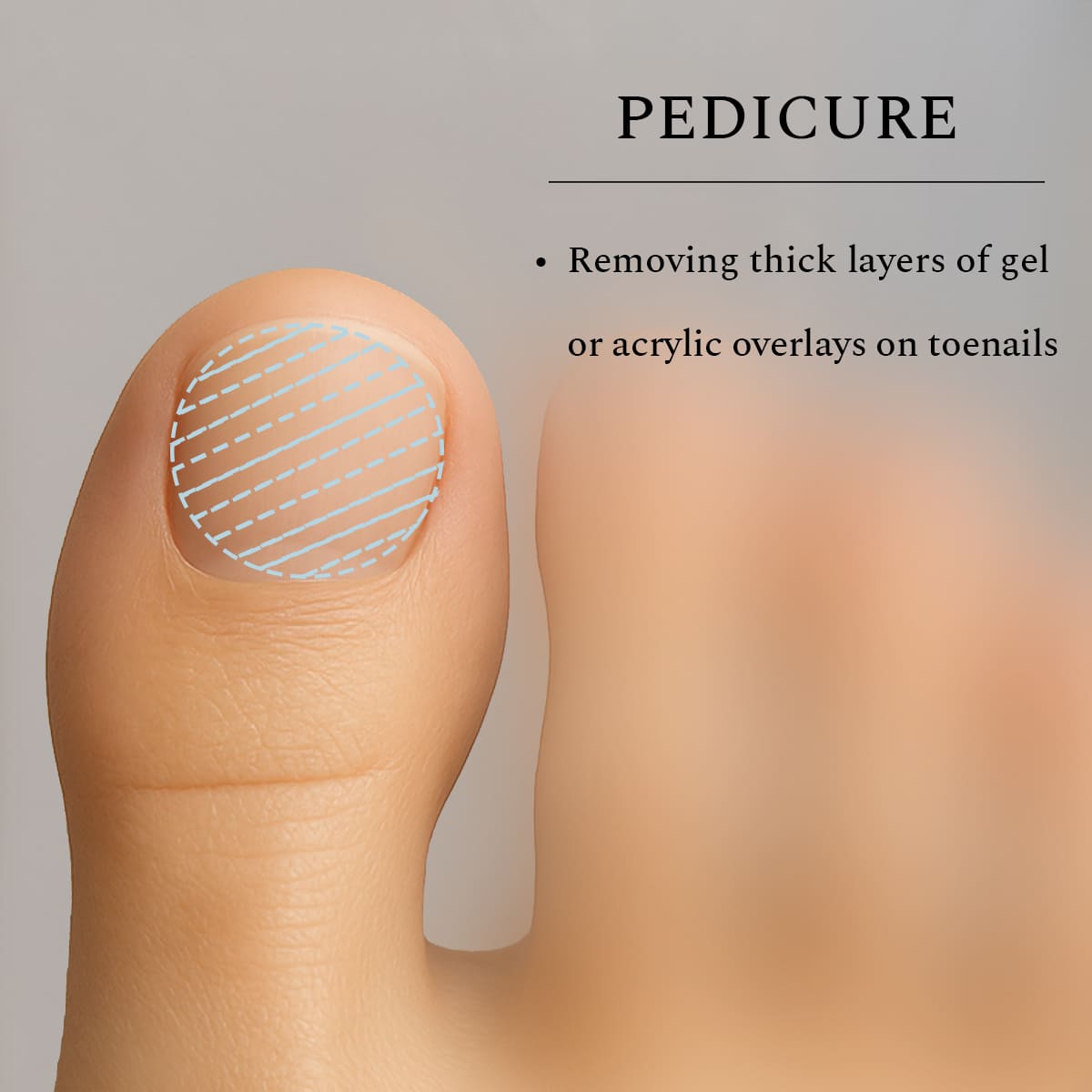 Carbide Bit Corn Medium, 6 mm