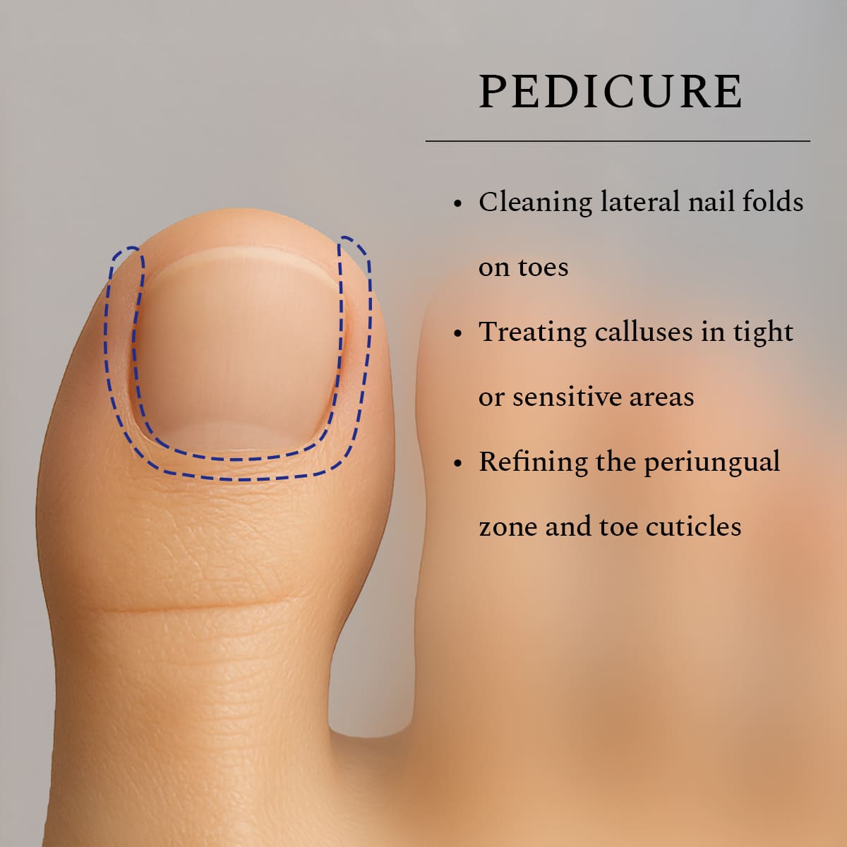 Diamond Bit Flame Fine 1,8 mm