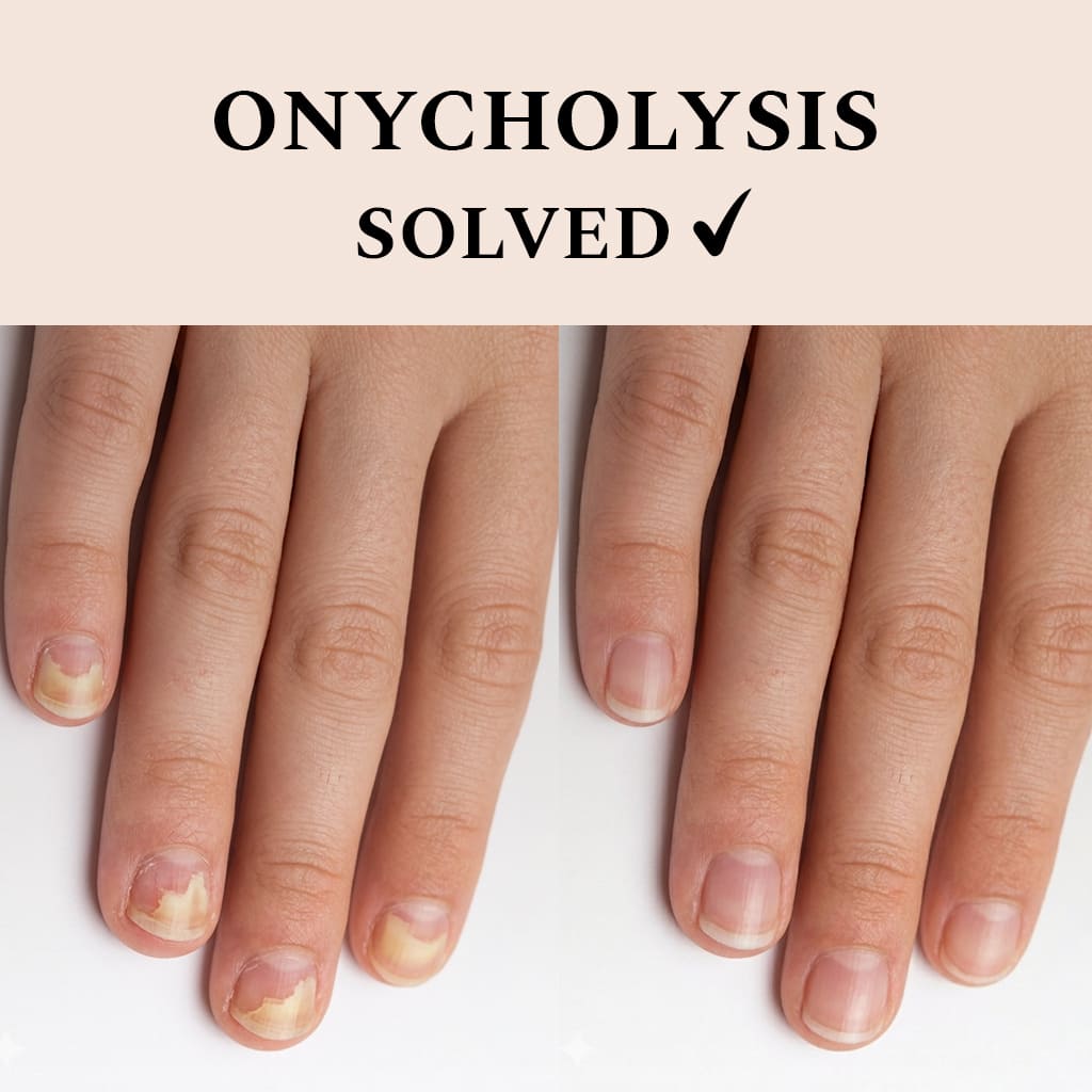 Nail Recover, 12 ml.