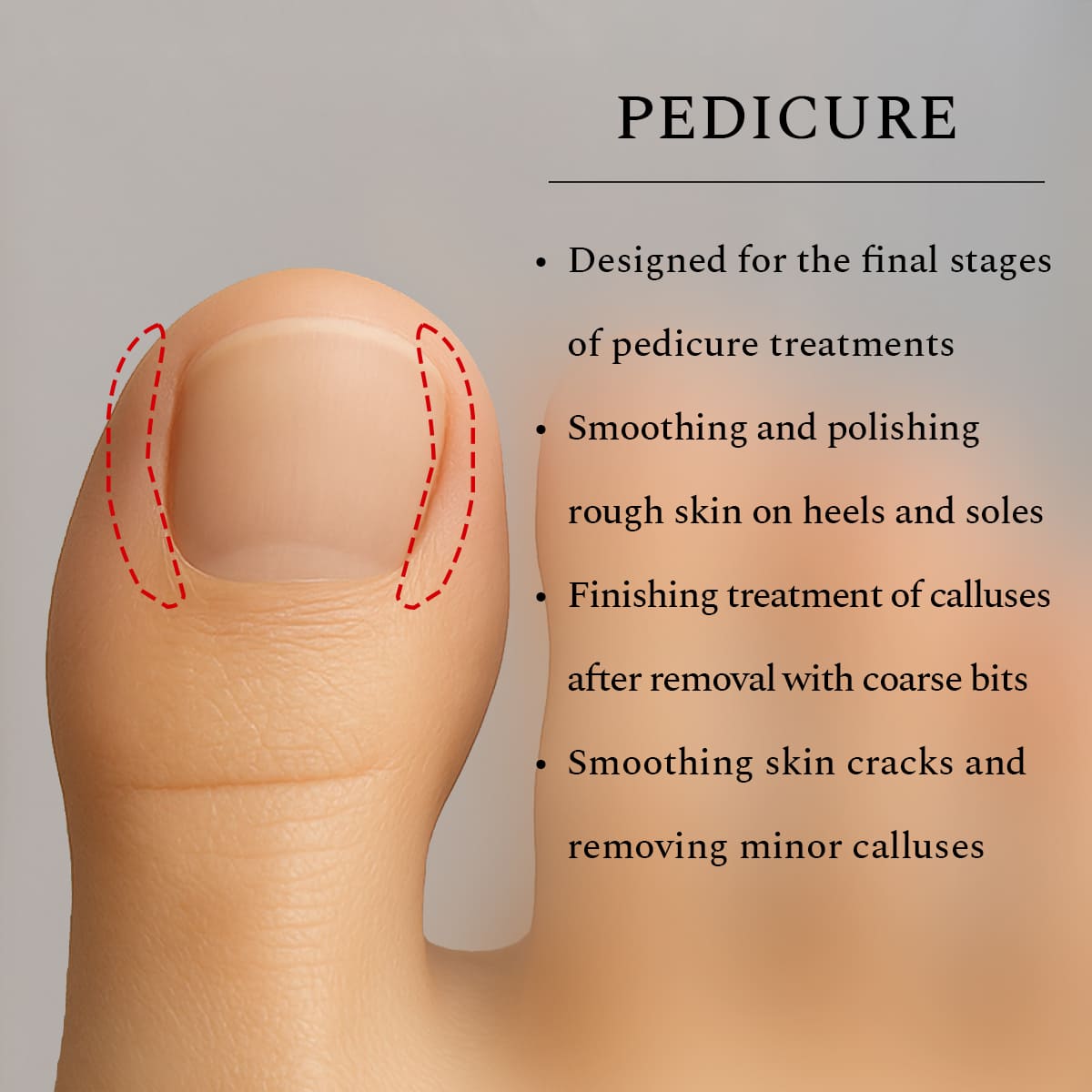 Silicone Bit Cone Coarse 6 mm