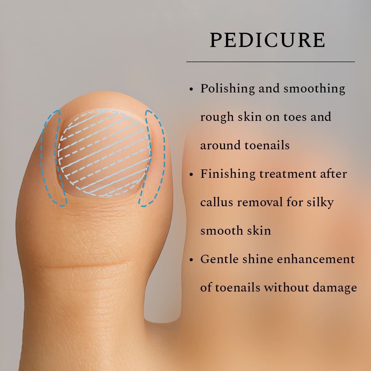 Silicone Bit Cone Medium, 4 mm